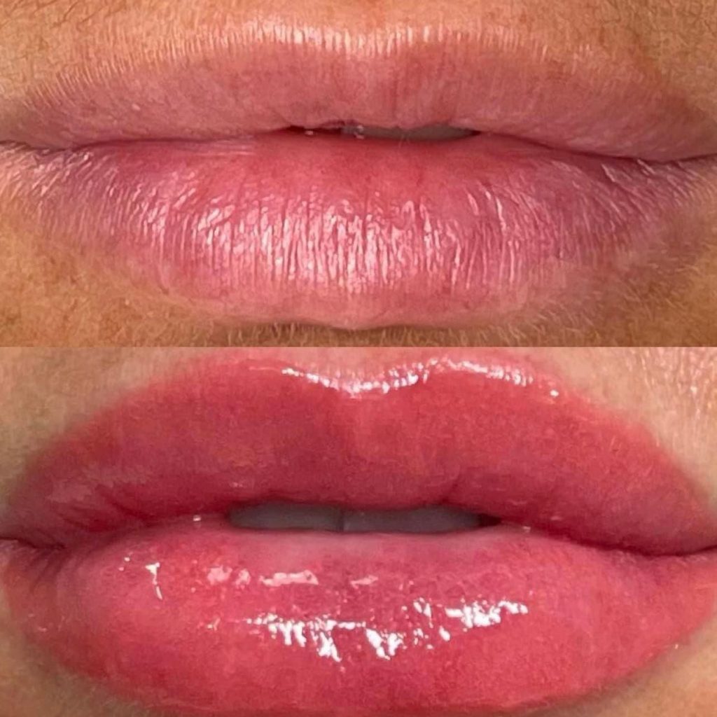micropigmentaicíon de labios